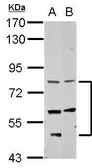 Anti-CCDC114 antibody used in Western Blot (WB). GTX123287