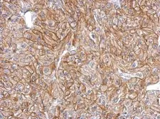 Anti-FLRT2 antibody used in IHC (Paraffin sections) (IHC-P). GTX123309