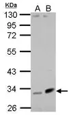 Anti-Fibulin 7 antibody used in Western Blot (WB). GTX123324