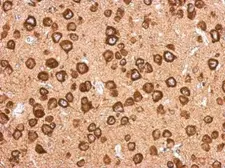 Anti-SEC6 antibody used in IHC (Paraffin sections) (IHC-P). GTX123688