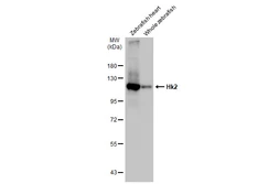 Anti-Hk2 antibody used in Western Blot (WB). GTX124375