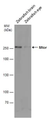 Anti-Mtor antibody used in Western Blot (WB). GTX124771