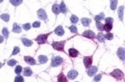 Anti-GPR45 antibody used in Immunocytochemistry/ Immunofluorescence (ICC/IF). GTX12574