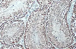 Anti-TET1 antibody [N1], N-term used in IHC (Paraffin sections) (IHC-P). GTX125888