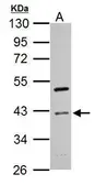 Anti-Cyclin I antibody used in Western Blot (WB). GTX125940
