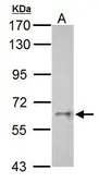 Anti-Cyp26c1 antibody used in Western Blot (WB). GTX125985