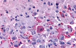 Anti-TM7SF1/GPR137B antibody used in IHC (Paraffin sections) (IHC-P). GTX12800
