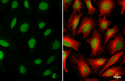 Anti-CDYL2 antibody used in Immunocytochemistry/ Immunofluorescence (ICC/IF). GTX128239