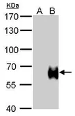 Anti-Influenza B virus Hemagglutinin (HA) antibody used in Western Blot (WB). GTX128543