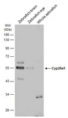 Anti-Cyp26a1 antibody used in Western Blot (WB). GTX128730