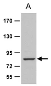 Anti-Zranb1b antibody used in Western Blot (WB). GTX129068