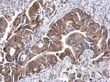 Anti-ATG16L1 antibody used in IHC (Paraffin sections) (IHC-P). GTX129098
