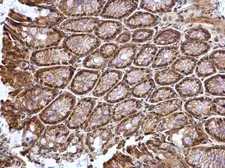 Anti-ATOH7 antibody used in IHC (Paraffin sections) (IHC-P). GTX129391
