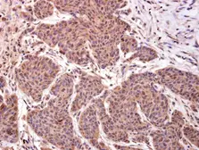 Anti-LMO4 antibody used in IHC (Paraffin sections) (IHC-P). GTX129616