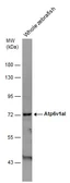 Anti-Atp6v1al antibody used in Western Blot (WB). GTX129736
