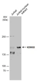 Anti-KDM5D antibody used in Western Blot (WB). GTX129826