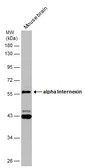 Anti-alpha Internexin antibody used in Western Blot (WB). GTX130053