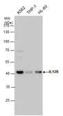 Anti-IL12B / IL12 p40 antibody used in Western Blot (WB). GTX130093