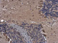 Anti-TCPTP antibody used in IHC (Paraffin sections) (IHC-P). GTX130319