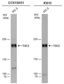 Anti-TSC2 antibody used in Western Blot (WB). GTX130511