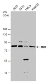 Anti-MUT antibody used in Western Blot (WB). GTX130666