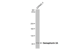 Anti-Semaphorin 3A antibody used in Western Blot (WB). GTX130671