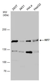 Anti-KIF7 antibody used in Western Blot (WB). GTX130782