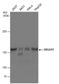Anti-SRGAP2 antibody used in Western Blot (WB). GTX130797