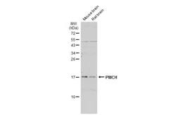 Anti-PMCH antibody used in Western Blot (WB). GTX130799