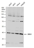 Anti-DRG1 antibody used in Western Blot (WB). GTX130850