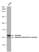 Anti-Spastin antibody used in Western Blot (WB). GTX130877