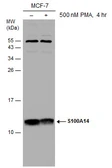Anti-S100A14 antibody used in Western Blot (WB). GTX131119