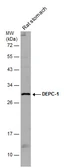 Anti-ALKBH3 antibody used in Western Blot (WB). GTX131151