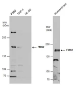 Anti-FMN2 antibody used in Western Blot (WB). GTX131161