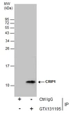 Anti-CRIP1 antibody used in Immunoprecipitation (IP). GTX131195