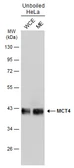 Anti-MCT4 antibody used in Western Blot (WB). GTX131626