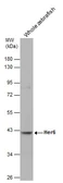 Anti-Her6 antibody used in Western Blot (WB). GTX132238