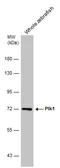 Anti-Plk1 antibody used in Western Blot (WB). GTX132376