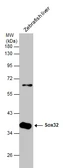 Anti-Sox32 antibody used in Western Blot (WB). GTX132380