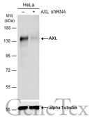 Anti-AXL antibody used in Western Blot (WB). GTX132387