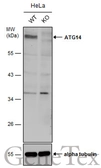 Anti-ATG14 antibody used in Western Blot (WB). GTX132468
