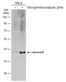 Anti-Aurora B antibody used in Western Blot (WB). GTX132702