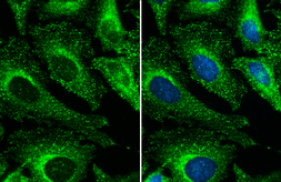 Anti-Clathrin Heavy chain antibody used in Immunocytochemistry/ Immunofluorescence (ICC/IF). GTX132976