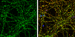 Anti-Serotonin Transporter antibody used in Immunocytochemistry/ Immunofluorescence (ICC/IF). GTX133101
