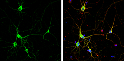 Anti-Dopamine Transporter antibody used in Immunocytochemistry/ Immunofluorescence (ICC/IF). GTX133152