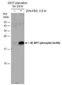 Anti-4E-BP1 (phospho Ser65) antibody used in Western Blot (WB). GTX133184