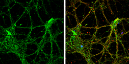 Anti-Reelin antibody used in Immunocytochemistry/ Immunofluorescence (ICC/IF). GTX133226