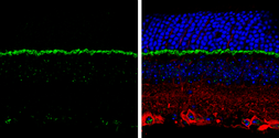 Anti-PSD95 antibody used in IHC (Paraffin sections) (IHC-P). GTX133255