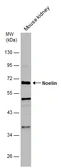 Anti-Noelin antibody used in Western Blot (WB). GTX133262