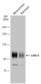 Anti-LRRC4 antibody used in Western Blot (WB). GTX133276